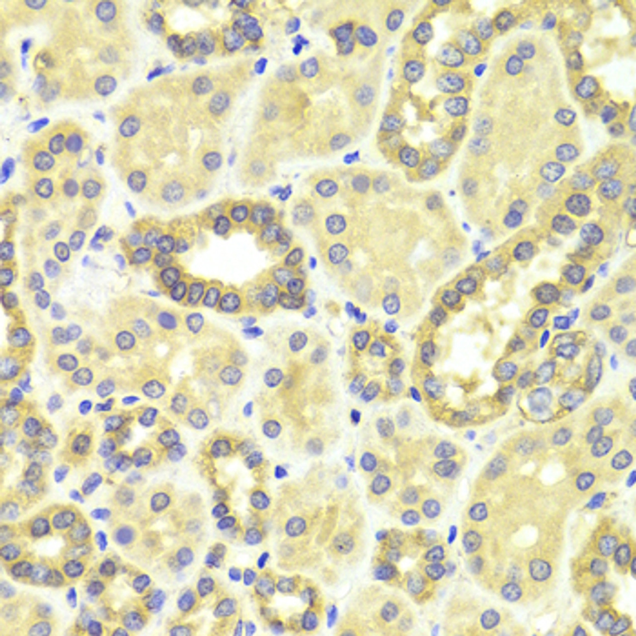 Immunohistochemistry of paraffin-embedded human kidney using MAP2K2 antibody (13-107) at dilution of 1:100 (40x lens) .