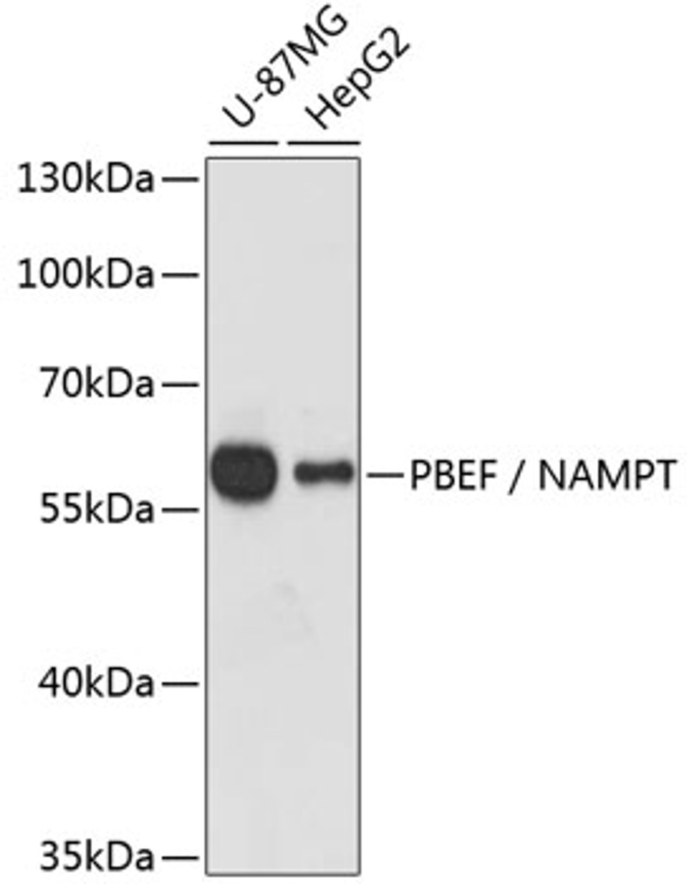 Western blot analysis of extracts of various cell lines, using PBEF / NAMPT antibody (13-109) at 1:1000 dilution.<br/>Secondary antibody: HRP Goat Anti-Rabbit IgG (H+L) at 1:10000 dilution.<br/>Lysates/proteins: 25ug per lane.<br/>Blocking buffer: 3% nonfat dry milk in TBST.<br/>Detection: ECL Basic Kit.<br/>Exposure time: 90s.