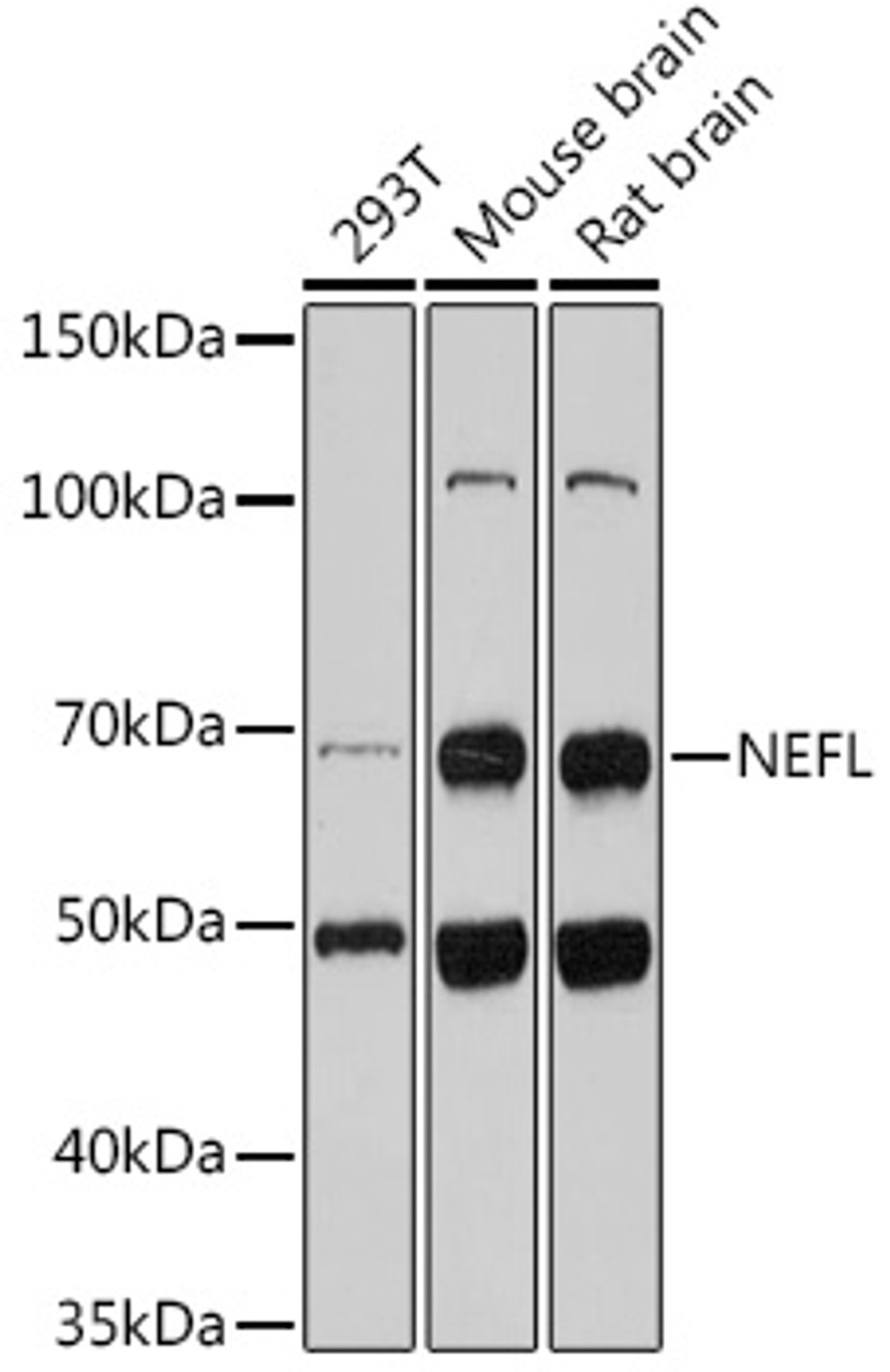 Western blot analysis of extracts of MCF-7 cells, using NEFL antibody (13-110) .<br/>Secondary antibody: HRP Goat Anti-Rabbit IgG (H+L) at 1:10000 dilution.<br/>Lysates/proteins: 25ug per lane.<br/>Blocking buffer: 3% nonfat dry milk in TBST.