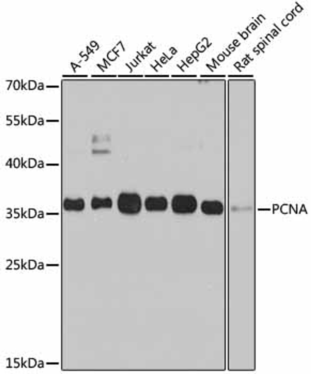 Western blot analysis of extracts of various cell lines, using PCNA antibody (13-114) at 1:1000 dilution.<br/>Secondary antibody: HRP Goat Anti-Rabbit IgG (H+L) at 1:10000 dilution.<br/>Lysates/proteins: 25ug per lane.<br/>Blocking buffer: 3% nonfat dry milk in TBST.<br/>Detection: ECL Basic Kit.<br/>Exposure time: 60s.