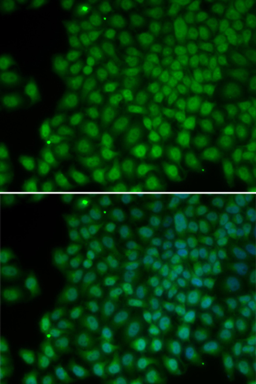 Immunofluorescence analysis of HeLa cells using POLR1C antibody (13-117) . Blue: DAPI for nuclear staining.