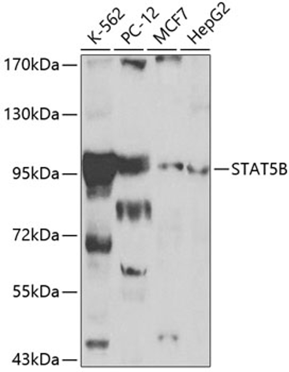 Western blot analysis of extracts of various cell lines, using STAT5B antibody (13-121) at 1:1000 dilution.<br/>Secondary antibody: HRP Goat Anti-Rabbit IgG (H+L) at 1:10000 dilution.<br/>Lysates/proteins: 25ug per lane.<br/>Blocking buffer: 3% nonfat dry milk in TBST.