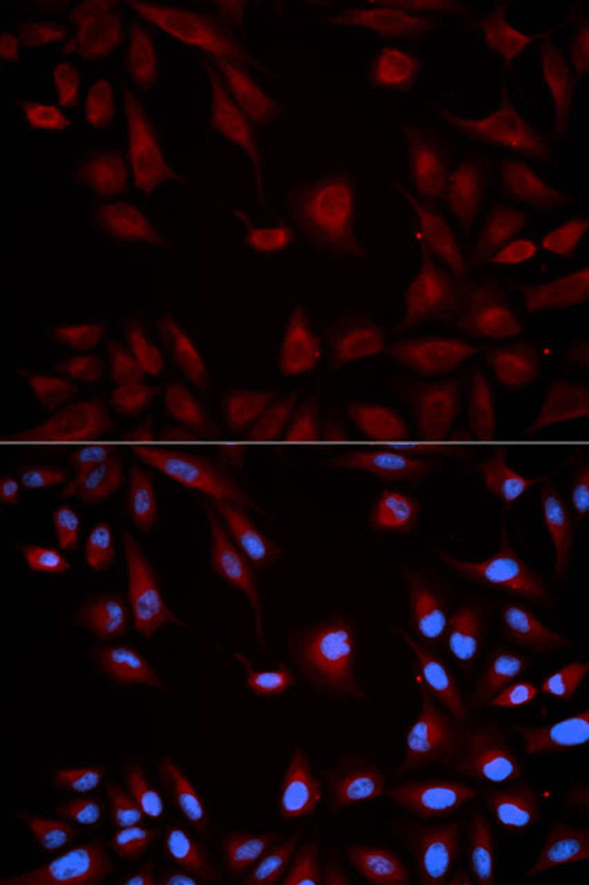 Immunofluorescence analysis of HeLa cells using STAT5B antibody (13-121) . Blue: DAPI for nuclear staining.