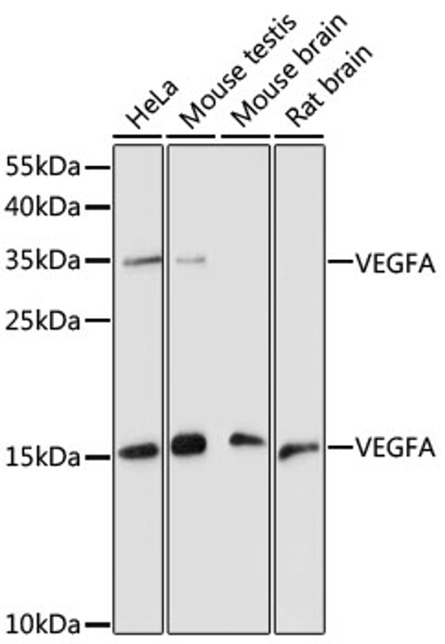 Western blot analysis of extracts of various cell lines, using VEGFA antibody (13-125) at 1:1000 dilution.<br/>Secondary antibody: HRP Goat Anti-Rabbit IgG (H+L) at 1:10000 dilution.<br/>Lysates/proteins: 25ug per lane.<br/>Blocking buffer: 3% nonfat dry milk in TBST.<br/>Detection: ECL Basic Kit.<br/>Exposure time: 90s.