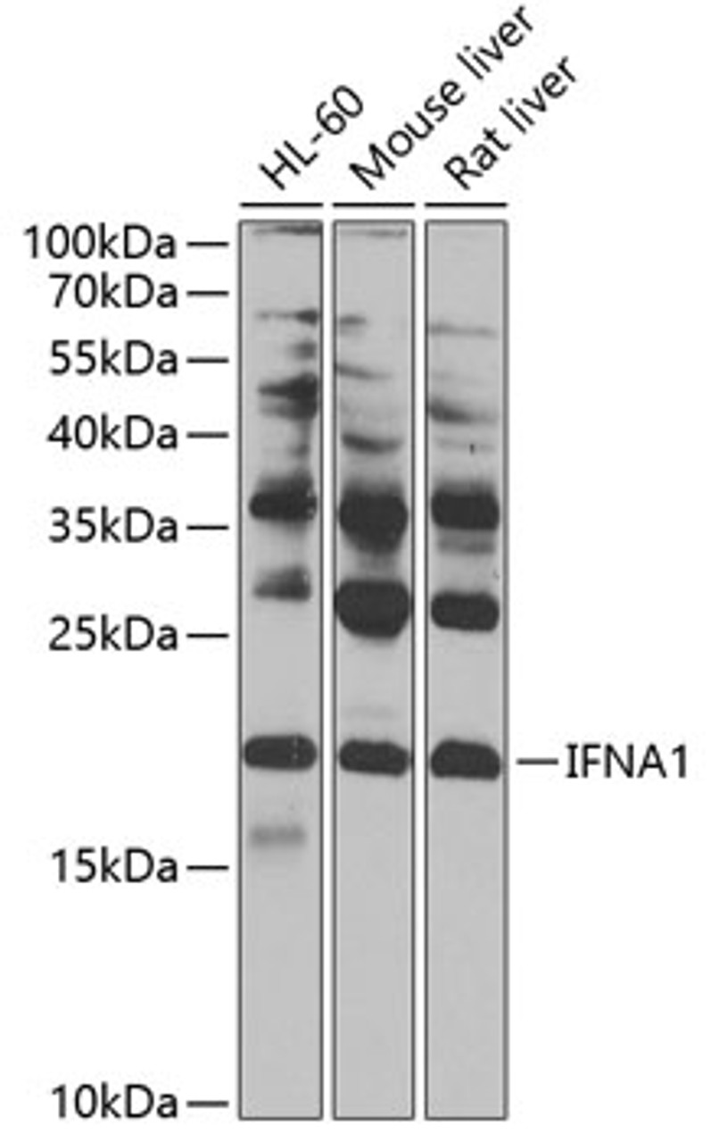 Western blot analysis of extracts of various cell lines, using IFNA1 antibody (13-128) at 1:1000 dilution.<br/>Secondary antibody: HRP Goat Anti-Rabbit IgG (H+L) at 1:10000 dilution.<br/>Lysates/proteins: 25ug per lane.<br/>Blocking buffer: 3% nonfat dry milk in TBST.<br/>Detection: ECL Basic Kit.<br/>Exposure time: 5s.
