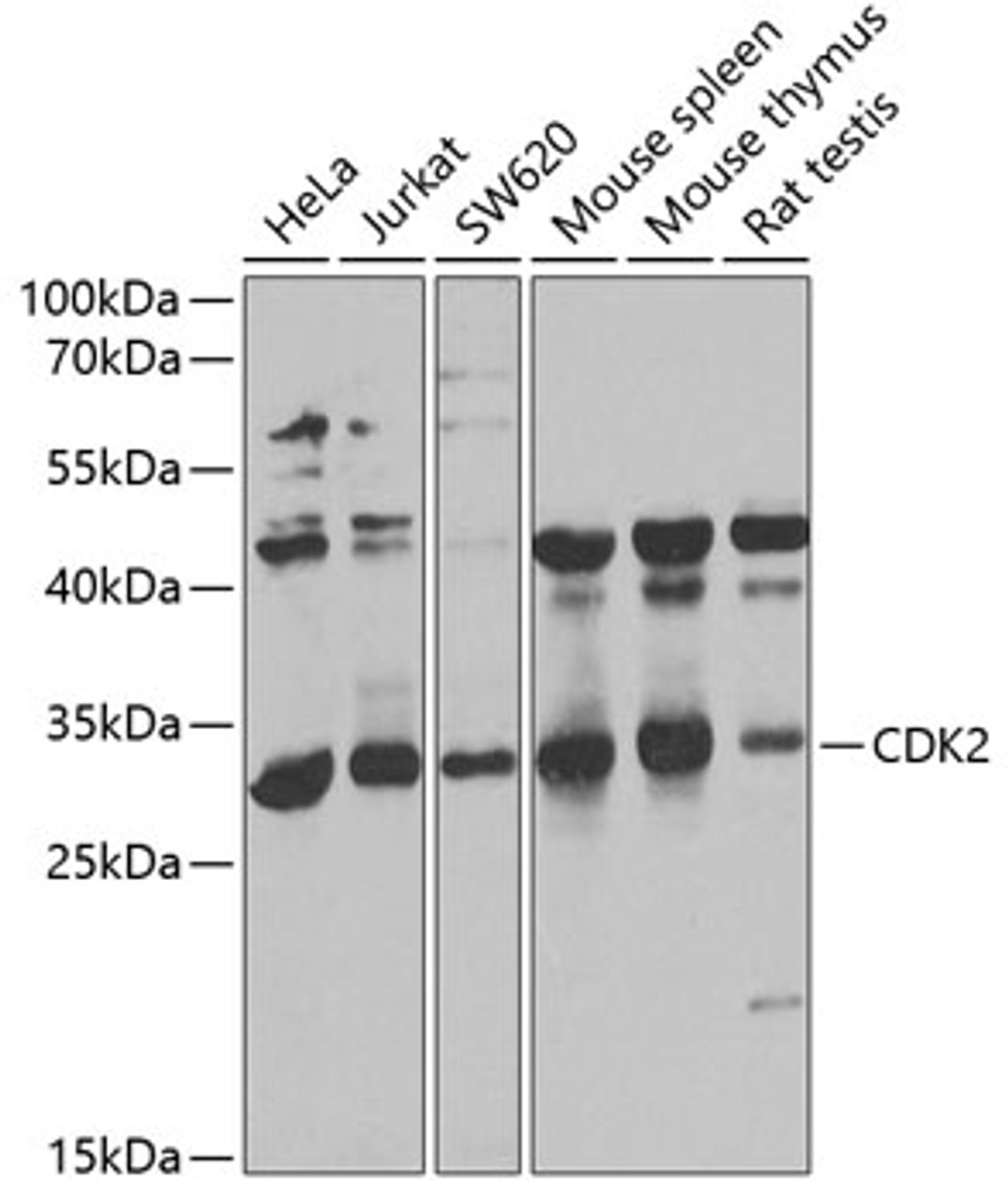 Western blot analysis of extracts of various cell lines, using CDK2 antibody (13-134) at 1:1000 dilution.<br/>Secondary antibody: HRP Goat Anti-Rabbit IgG (H+L) at 1:10000 dilution.<br/>Lysates/proteins: 25ug per lane.<br/>Blocking buffer: 3% nonfat dry milk in TBST.<br/>Detection: ECL Basic Kit.<br/>Exposure time: 5s.