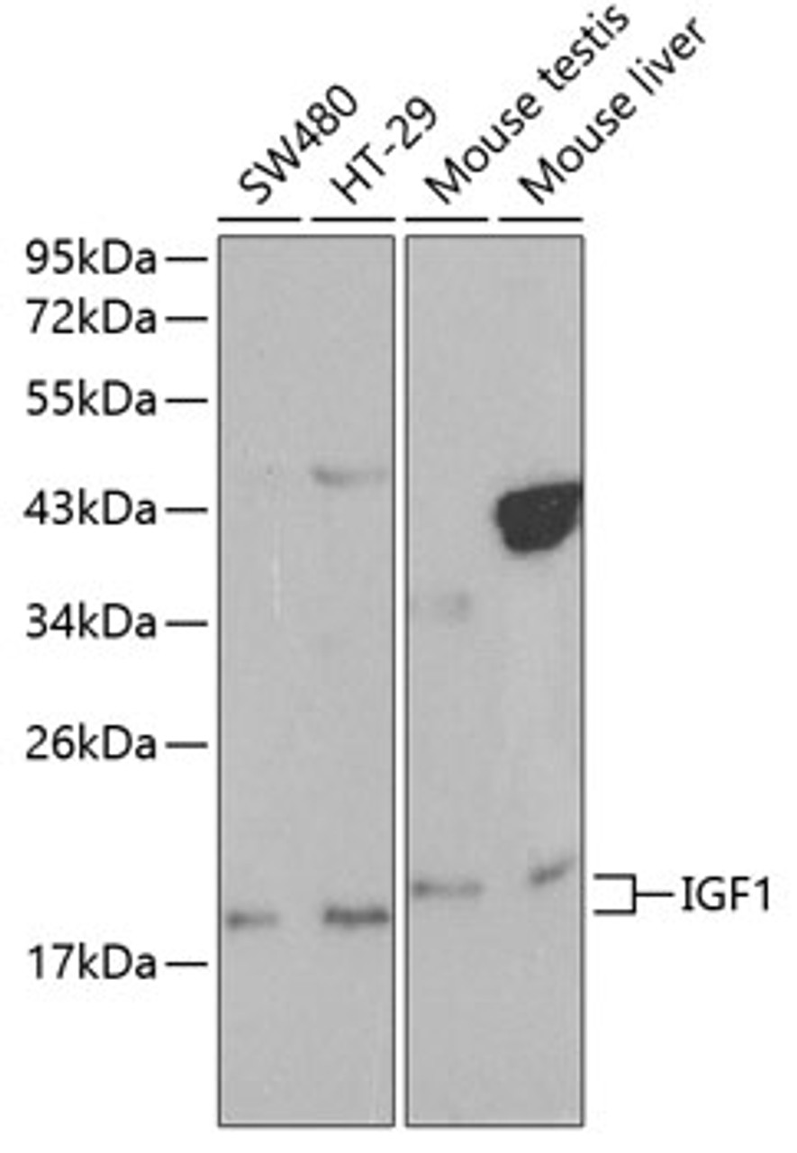 Western blot analysis of extracts of various cell lines, using IGF1 antibody (13-137) at 1:1000 dilution.<br/>Secondary antibody: HRP Goat Anti-Rabbit IgG (H+L) at 1:10000 dilution.<br/>Lysates/proteins: 25ug per lane.<br/>Blocking buffer: 3% nonfat dry milk in TBST.