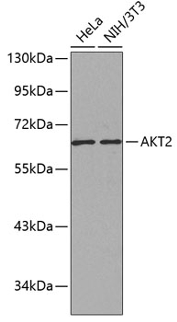 Western blot analysis of extracts of various cell lines, using AKT2 antibody (13-146) .<br/>Secondary antibody: HRP Goat Anti-Rabbit IgG (H+L) at 1:10000 dilution.<br/>Lysates/proteins: 25ug per lane.<br/>Blocking buffer: 3% nonfat dry milk in TBST.