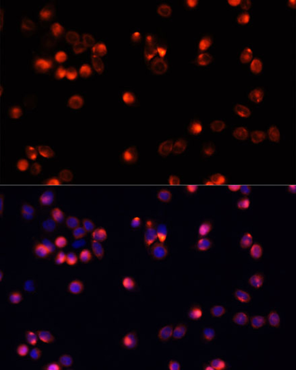 Immunofluorescence analysis of HeLa cells using AKT2 antibody (13-146) at dilution of 1:100. Blue: DAPI for nuclear staining.