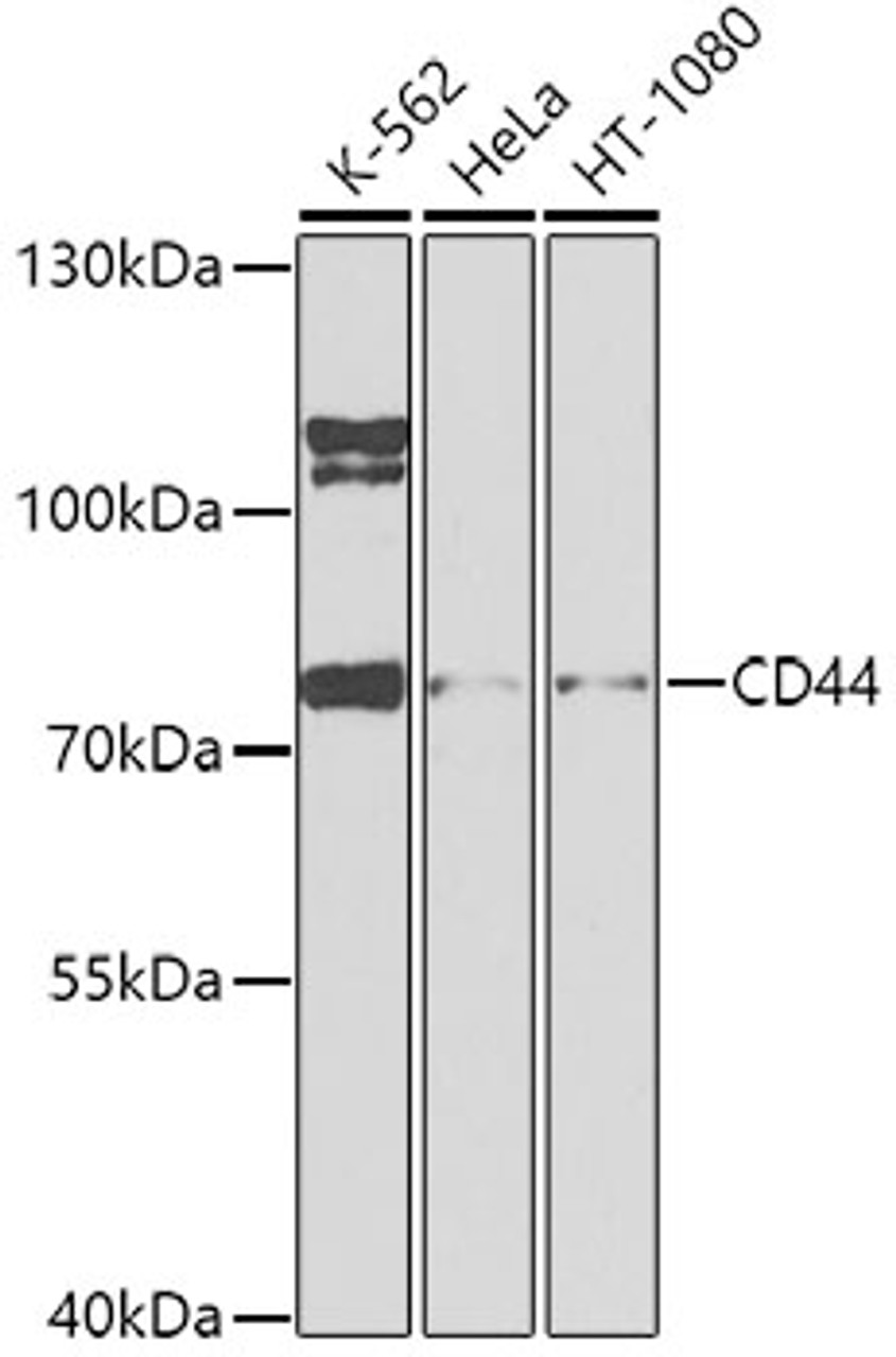 Western blot analysis of extracts of various cell lines, using CD44 antibody (13-147) at 1:1000 dilution.<br/>Secondary antibody: HRP Goat Anti-Rabbit IgG (H+L) at 1:10000 dilution.<br/>Lysates/proteins: 25ug per lane.<br/>Blocking buffer: 3% nonfat dry milk in TBST.<br/>Detection: ECL Basic Kit.<br/>Exposure time: 90s.