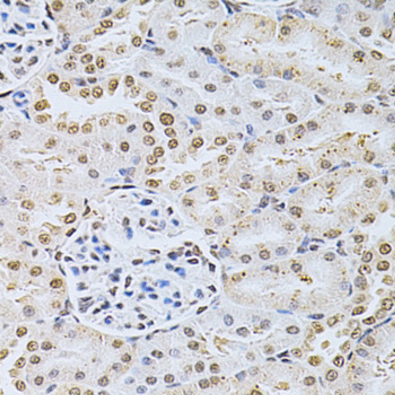 Immunohistochemistry of paraffin-embedded rat kidney using MDM2 Antibody (13-148) at dilution of 1:200 (40x lens) .