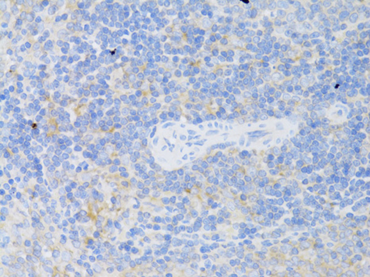 Immunohistochemistry of paraffin-embedded rat spleen using CD4 antibody (13-153) at dilution of 1:50 (40x lens) .