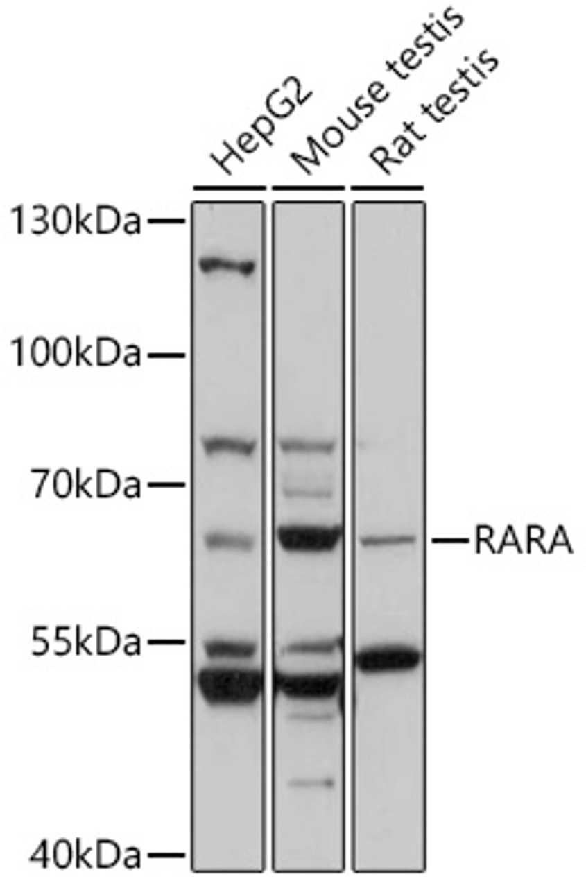 Western blot analysis of extracts of various cell lines, using RARA antibody (13-155) at 1:1000 dilution.<br/>Secondary antibody: HRP Goat Anti-Rabbit IgG (H+L) at 1:10000 dilution.<br/>Lysates/proteins: 25ug per lane.<br/>Blocking buffer: 3% nonfat dry milk in TBST.<br/>Detection: ECL Basic Kit.<br/>Exposure time: 10s.