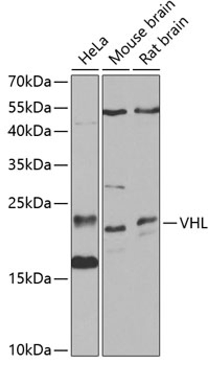 Western blot analysis of extracts of various cell lines, using VHL antibody (13-158) at 1:1000 dilution.<br/>Secondary antibody: HRP Goat Anti-Rabbit IgG (H+L) at 1:10000 dilution.<br/>Lysates/proteins: 25ug per lane.<br/>Blocking buffer: 3% nonfat dry milk in TBST.<br/>Detection: ECL Basic Kit.<br/>Exposure time: 30s.