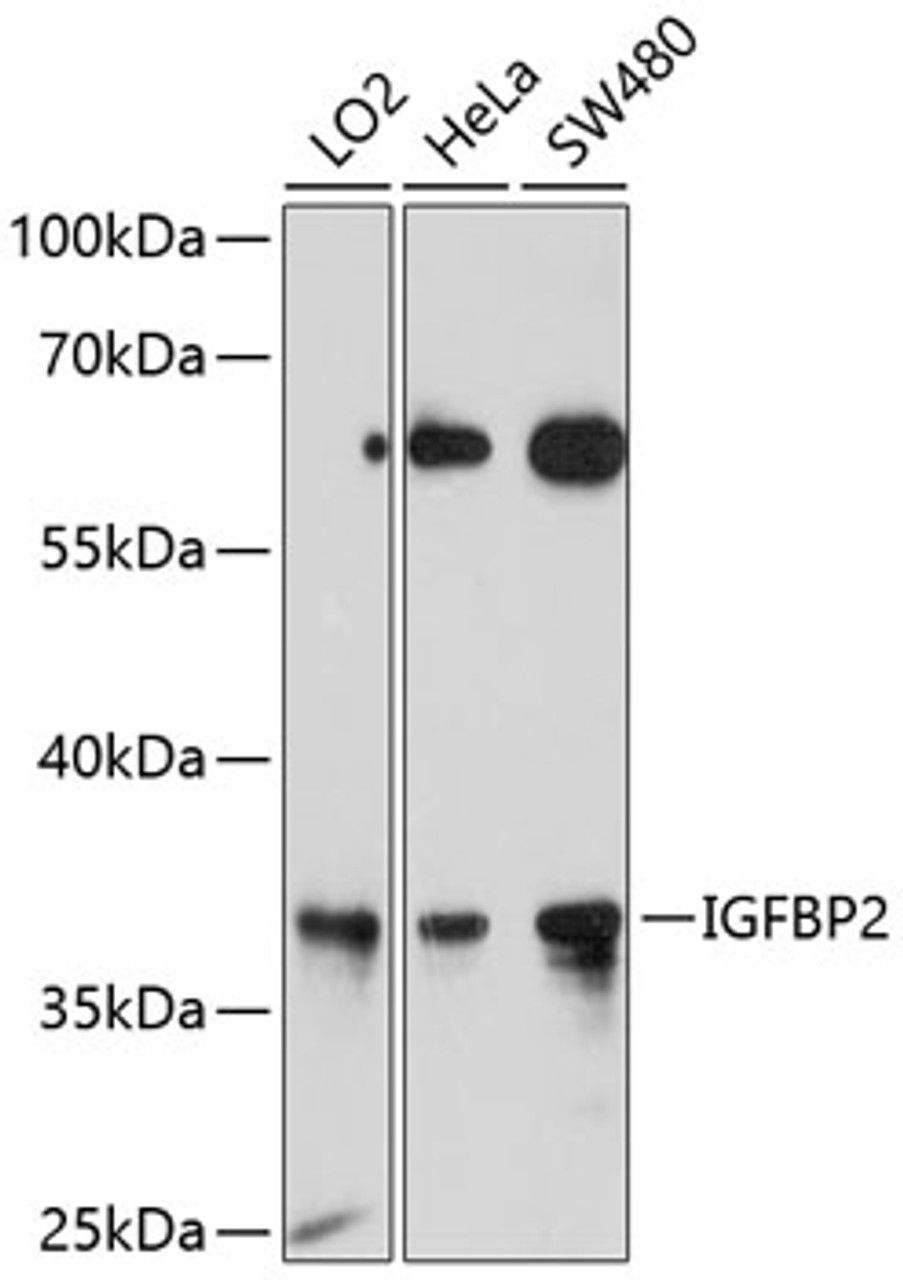 Western blot analysis of extracts of various cell lines, using IGFBP2 antibody (13-164) at 1:1000 dilution.<br/>Secondary antibody: HRP Goat Anti-Rabbit IgG (H+L) at 1:10000 dilution.<br/>Lysates/proteins: 25ug per lane.<br/>Blocking buffer: 3% nonfat dry milk in TBST.<br/>Detection: ECL Enhanced Kit.<br/>Exposure time: 30s.