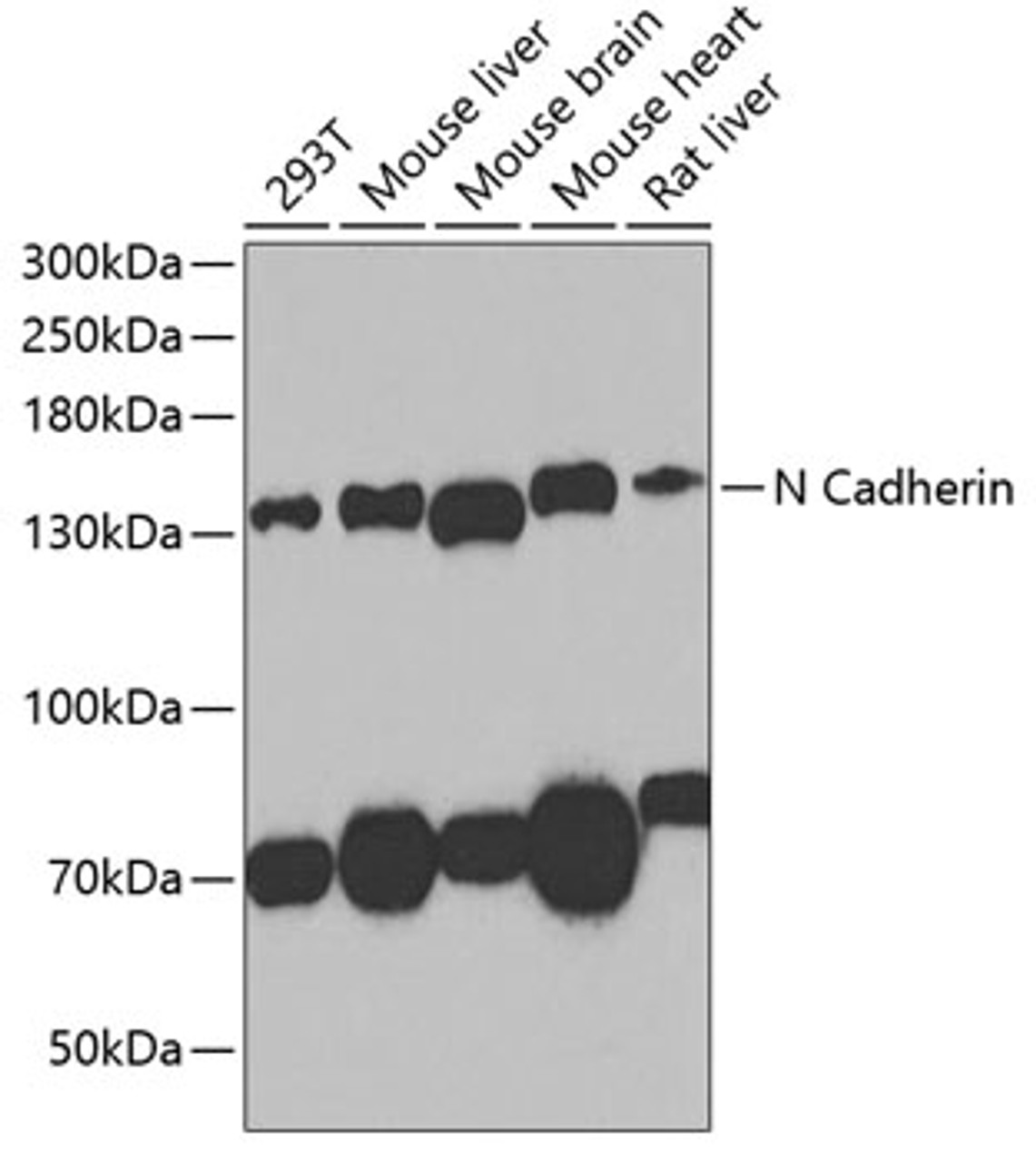 Western blot analysis of extracts of various cell lines, using N Cadherin antibody (13-172) at 1:1000 dilution.<br/>Secondary antibody: HRP Goat Anti-Rabbit IgG (H+L) at 1:10000 dilution.<br/>Lysates/proteins: 25ug per lane.<br/>Blocking buffer: 3% nonfat dry milk in TBST.<br/>Detection: ECL Basic Kit.<br/>Exposure time: 90s.