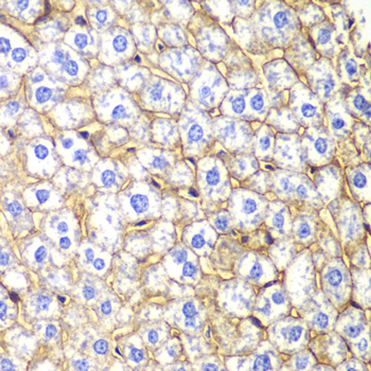Immunohistochemistry of paraffin-embedded mouse liver using N Cadherin Antibody (13-172) at dilution of 1:100 (40x lens) .