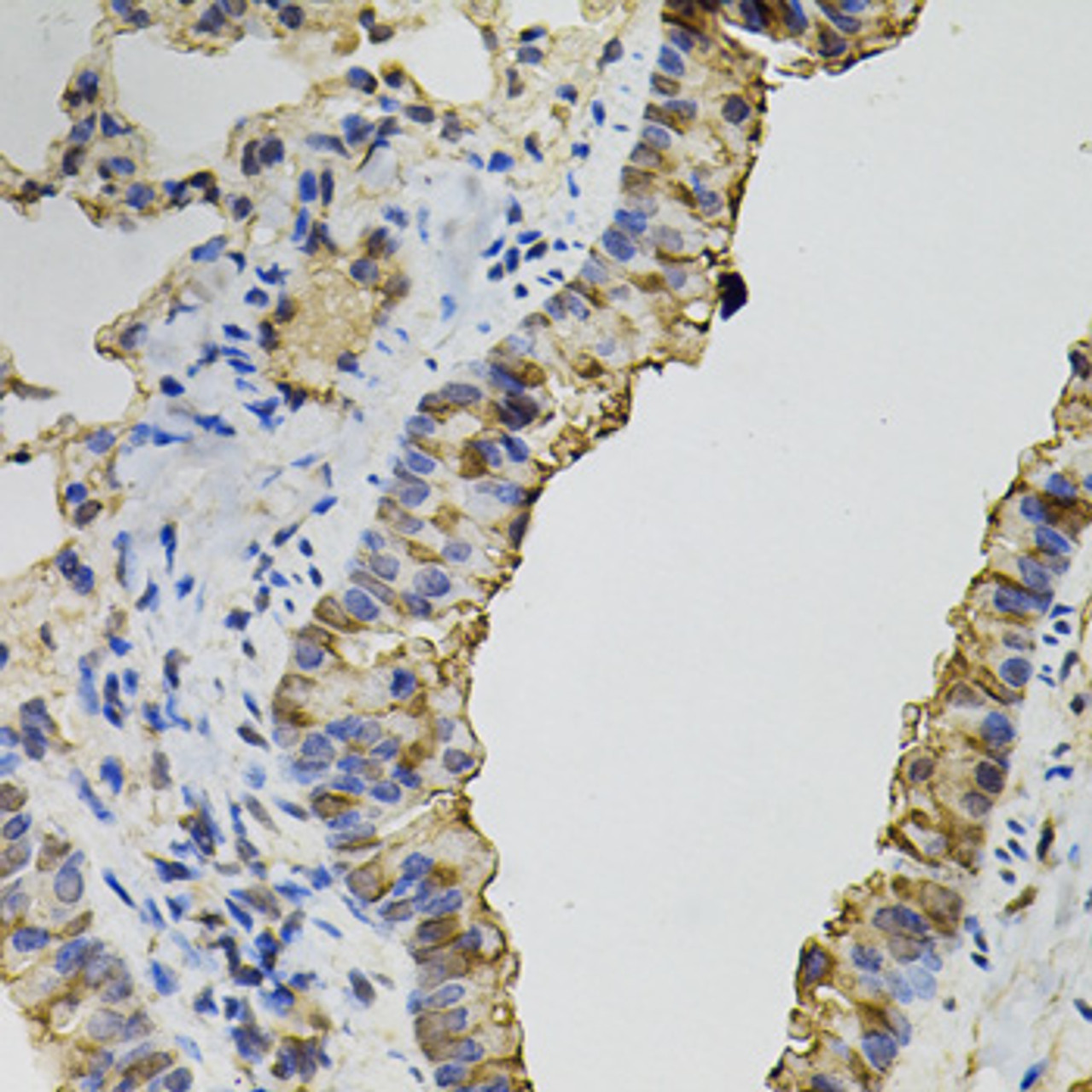 Immunohistochemistry of paraffin-embedded mouse lung using DNM2 antibody (13-192) (40x lens) .