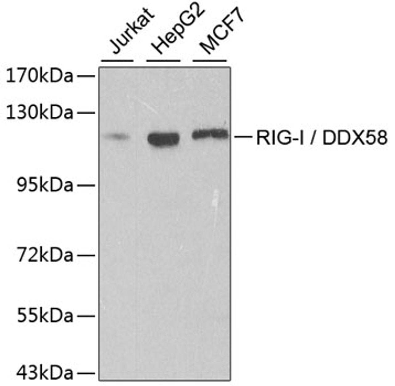Western blot analysis of extracts of various cell lines, using RIG-I / DDX58 antibody (13-201) at 1:500 dilution.<br/>Secondary antibody: HRP Goat Anti-Rabbit IgG (H+L) at 1:10000 dilution.<br/>Lysates/proteins: 25ug per lane.<br/>Blocking buffer: 3% nonfat dry milk in TBST.<br/>Detection: ECL Basic Kit.