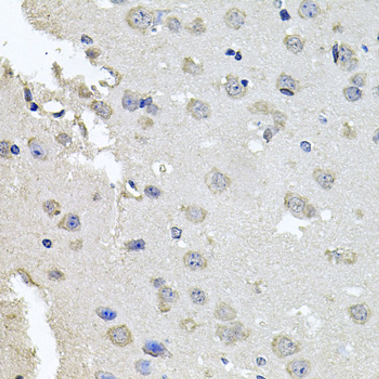 Immunohistochemistry of paraffin-embedded mouse brain using PKN1 antibody (13-202) at dilution of 1:100 (40x lens) .