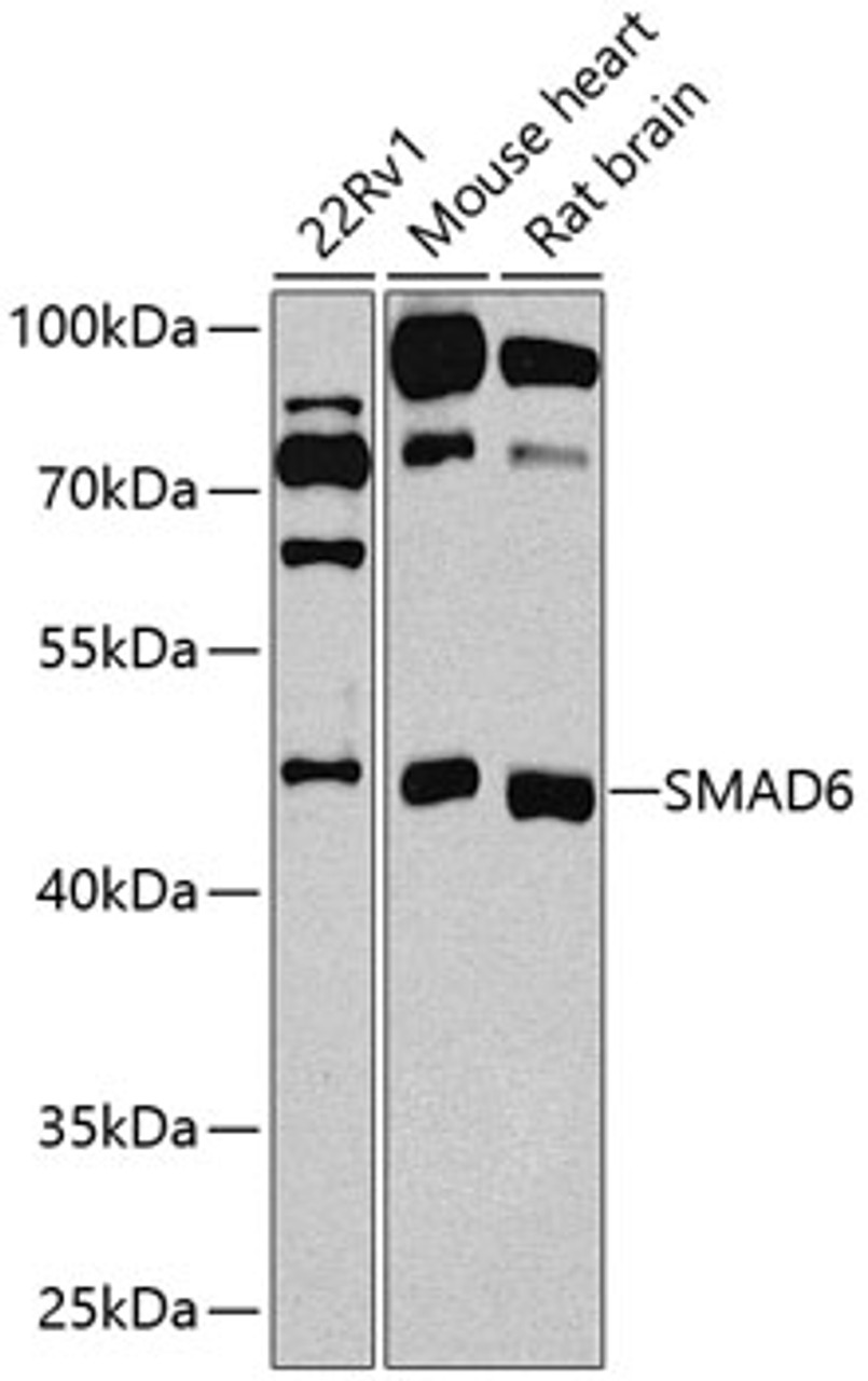 Western blot analysis of extracts of various cell lines, using SMAD6 antibody (13-209) at 1:1000 dilution.<br/>Secondary antibody: HRP Goat Anti-Rabbit IgG (H+L) at 1:10000 dilution.<br/>Lysates/proteins: 25ug per lane.<br/>Blocking buffer: 3% nonfat dry milk in TBST.<br/>Detection: ECL Basic Kit.<br/>Exposure time: 15s.