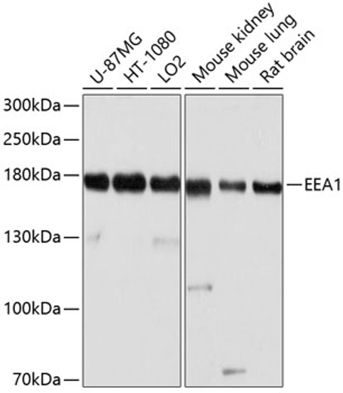 Western blot analysis of extracts of various cell lines, using EEA1 antibody (13-213) at 1:1000 dilution.<br/>Secondary antibody: HRP Goat Anti-Rabbit IgG (H+L) at 1:10000 dilution.<br/>Lysates/proteins: 25ug per lane.<br/>Blocking buffer: 3% nonfat dry milk in TBST.<br/>Detection: ECL Basic Kit.<br/>Exposure time: 5s.