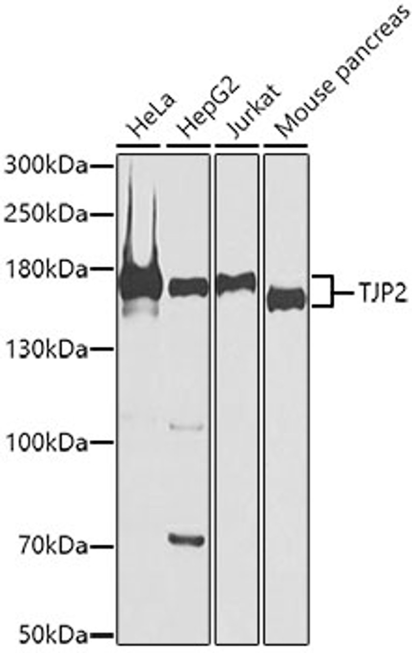 Western blot analysis of extracts of various cell lines, using TJP2 antibody (13-214) at 1:1000 dilution.<br/>Secondary antibody: HRP Goat Anti-Rabbit IgG (H+L) at 1:10000 dilution.<br/>Lysates/proteins: 25ug per lane.<br/>Blocking buffer: 3% nonfat dry milk in TBST.<br/>Detection: ECL Basic Kit.<br/>Exposure time: 90s.