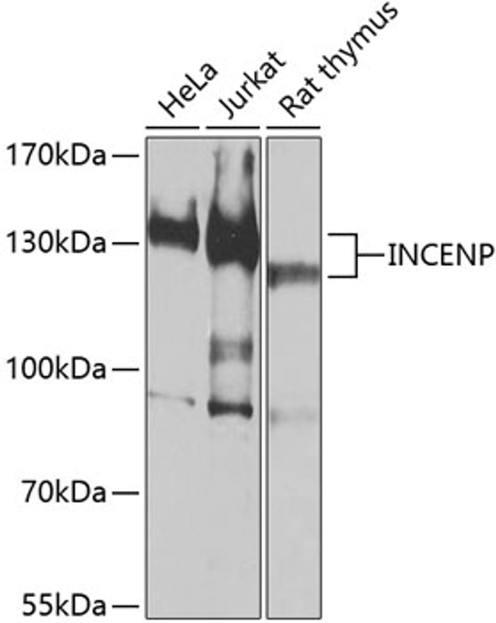Western blot analysis of extracts of various cell lines, using INCENP antibody (13-222) at 1:1000 dilution.<br/>Secondary antibody: HRP Goat Anti-Rabbit IgG (H+L) at 1:10000 dilution.<br/>Lysates/proteins: 25ug per lane.<br/>Blocking buffer: 3% nonfat dry milk in TBST.<br/>Detection: ECL Basic Kit.<br/>Exposure time: 30s.