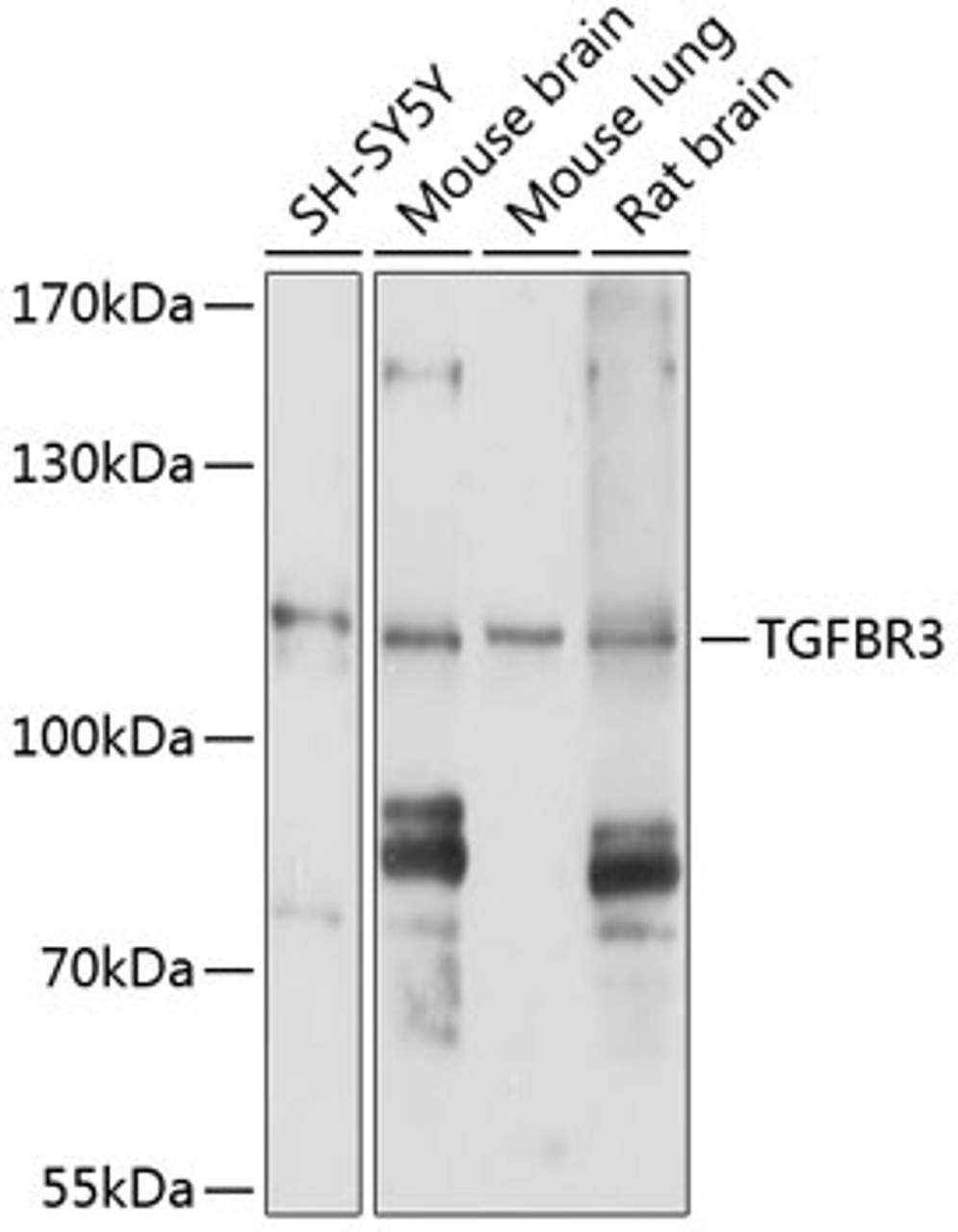 Western blot analysis of extracts of various cell lines, using TGFBR3 antibody (13-224) at 1:1000 dilution.<br/>Secondary antibody: HRP Goat Anti-Rabbit IgG (H+L) at 1:10000 dilution.<br/>Lysates/proteins: 25ug per lane.<br/>Blocking buffer: 3% nonfat dry milk in TBST.<br/>Detection: ECL Basic Kit.<br/>Exposure time: 10s.