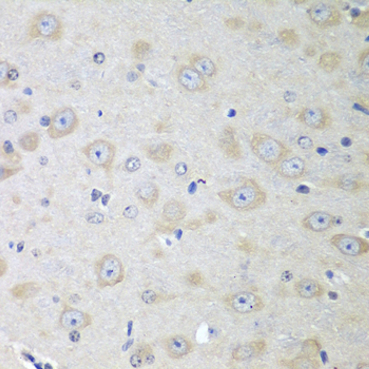 Immunohistochemistry of paraffin-embedded mouse brain using YES1 antibody (13-225) at dilution of 1:100 (40x lens) .