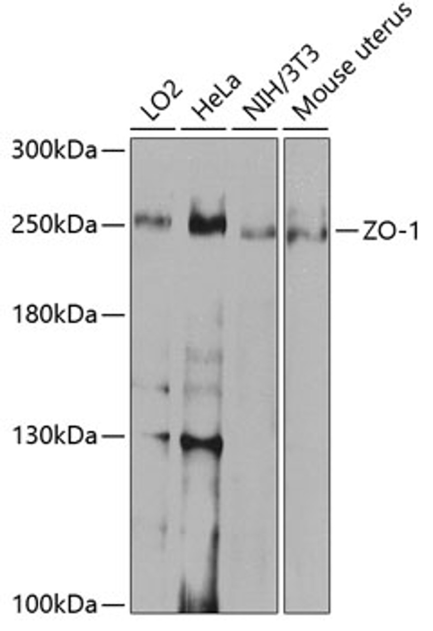 Western blot analysis of extracts of various cell lines, using ZO-1 antibody (13-238) at 1:1000 dilution.<br/>Secondary antibody: HRP Goat Anti-Rabbit IgG (H+L) at 1:10000 dilution.<br/>Lysates/proteins: 25ug per lane.<br/>Blocking buffer: 3% nonfat dry milk in TBST.<br/>Detection: ECL Enhanced Kit.<br/>Exposure time: 15s.