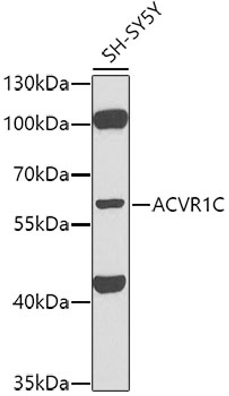 Western blot analysis of extracts of SH-SY5Y cells, using ACVR1C antibody (13-243) at 1:1000 dilution.<br/>Secondary antibody: HRP Goat Anti-Rabbit IgG (H+L) at 1:10000 dilution.<br/>Lysates/proteins: 25ug per lane.<br/>Blocking buffer: 3% nonfat dry milk in TBST.<br/>Detection: ECL Basic Kit.<br/>Exposure time: 90s.