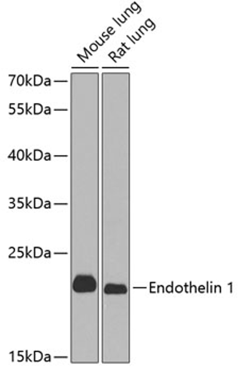 Western blot analysis of extracts of various cell lines, using Endothelin 1 antibody (13-247) at 1:1000 dilution.<br/>Secondary antibody: HRP Goat Anti-Rabbit IgG (H+L) at 1:10000 dilution.<br/>Lysates/proteins: 25ug per lane.<br/>Blocking buffer: 3% nonfat dry milk in TBST.<br/>Detection: ECL Basic Kit.<br/>Exposure time: 30s.