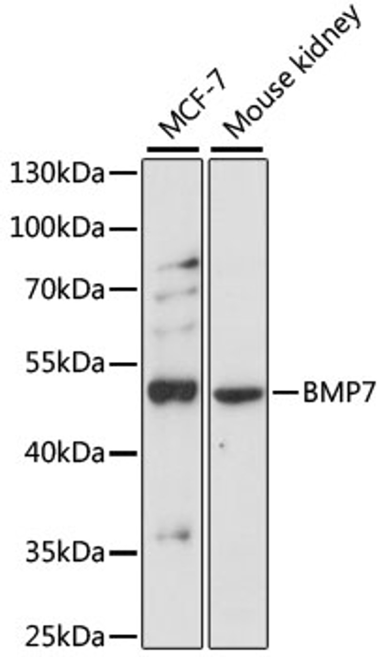 Western blot analysis of extracts of various cell lines, using BMP7 antibody (13-254) at 1:3000 dilution.<br/>Secondary antibody: HRP Goat Anti-Rabbit IgG (H+L) at 1:10000 dilution.<br/>Lysates/proteins: 25ug per lane.<br/>Blocking buffer: 3% nonfat dry milk in TBST.<br/>Detection: ECL Basic Kit.<br/>Exposure time: 90s.