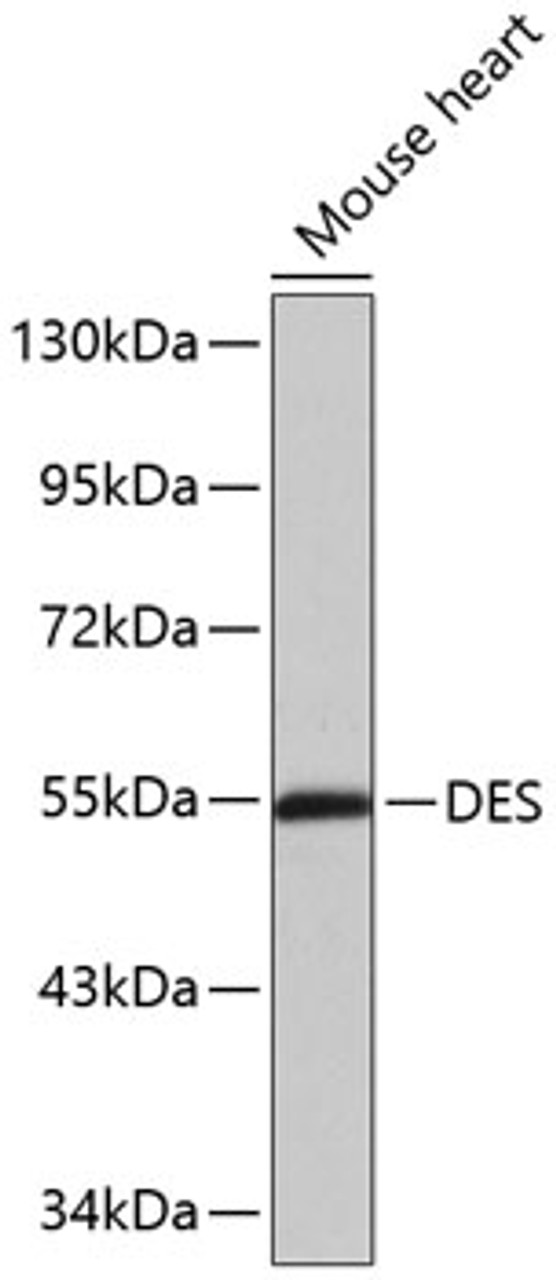 Western blot analysis of extracts of mouse heart, using DES antibody (13-255) .<br/>Secondary antibody: HRP Goat Anti-Rabbit IgG (H+L) at 1:10000 dilution.<br/>Lysates/proteins: 25ug per lane.<br/>Blocking buffer: 3% nonfat dry milk in TBST.