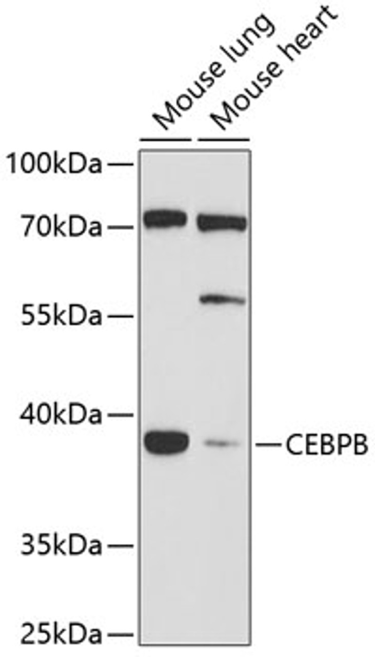 Western blot analysis of extracts of various cell lines, using CEBPB antibody (13-262) at 1:1000 dilution.<br/>Secondary antibody: HRP Goat Anti-Rabbit IgG (H+L) at 1:10000 dilution.<br/>Lysates/proteins: 25ug per lane.<br/>Blocking buffer: 3% nonfat dry milk in TBST.<br/>Detection: ECL Basic Kit.<br/>Exposure time: 90s.
