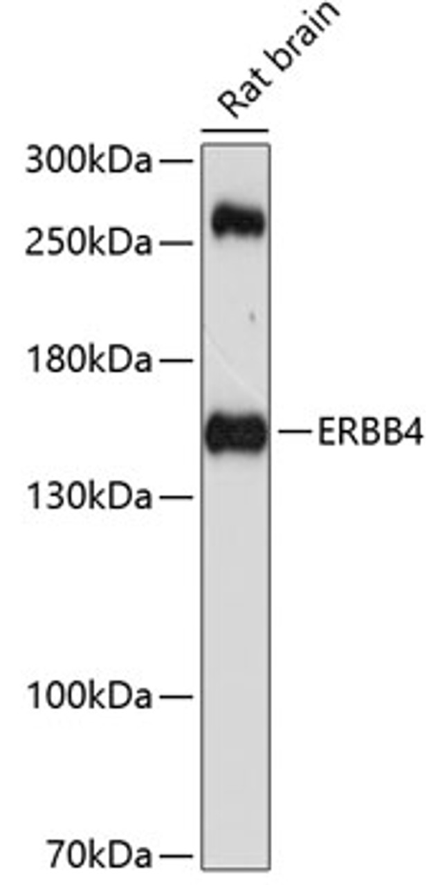 Western blot analysis of extracts of rat brain, using ERBB4 antibody (13-273) at 1:1000 dilution.<br/>Secondary antibody: HRP Goat Anti-Rabbit IgG (H+L) at 1:10000 dilution.<br/>Lysates/proteins: 25ug per lane.<br/>Blocking buffer: 3% nonfat dry milk in TBST.<br/>Detection: ECL Basic Kit.<br/>Exposure time: 90s.