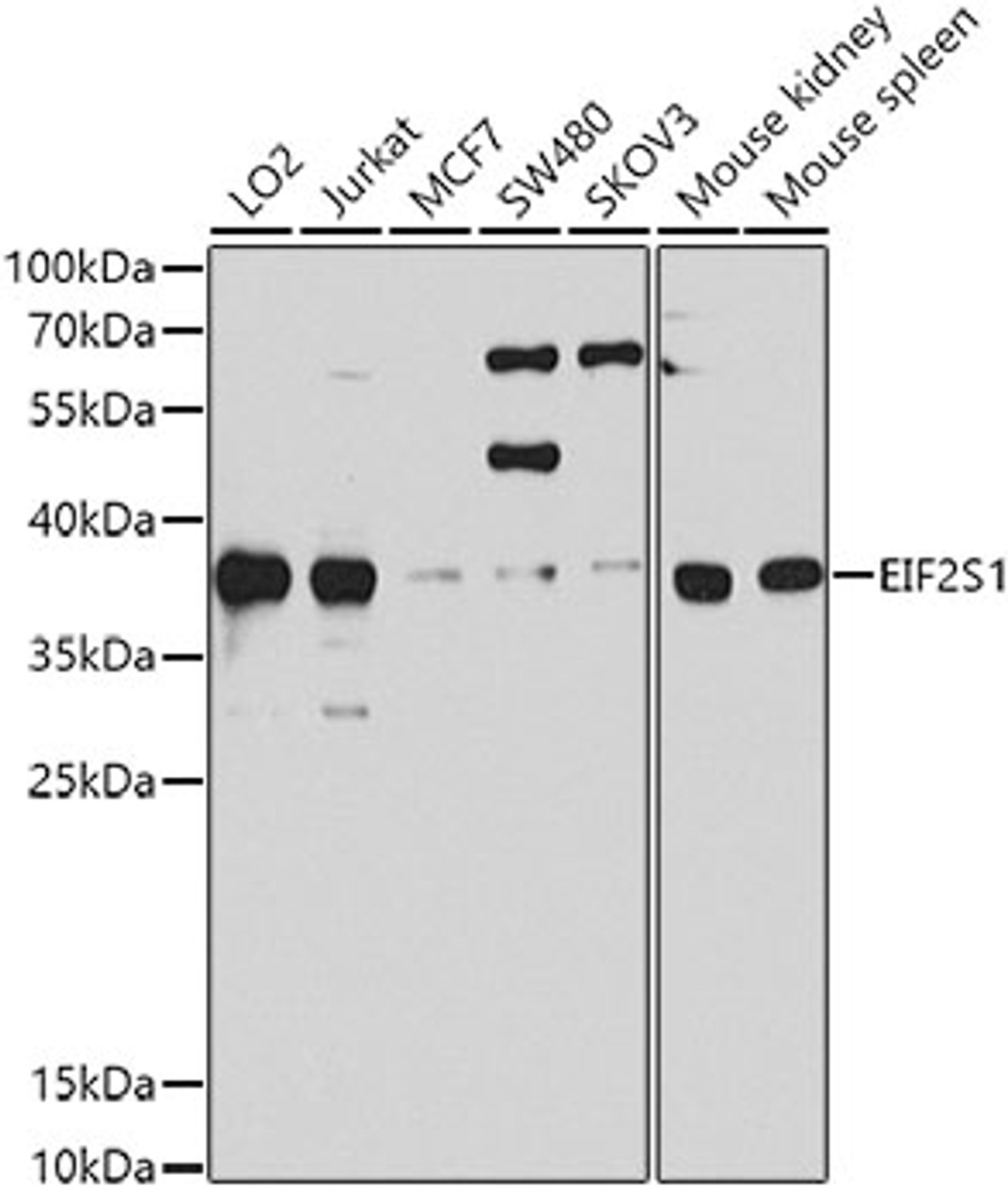 Western blot analysis of extracts of various cell lines, using EIF2S1 antibody (13-277) at 1:1000 dilution.<br/>Secondary antibody: HRP Goat Anti-Rabbit IgG (H+L) at 1:10000 dilution.<br/>Lysates/proteins: 25ug per lane.<br/>Blocking buffer: 3% nonfat dry milk in TBST.<br/>Detection: ECL Basic Kit.<br/>Exposure time: 90s.