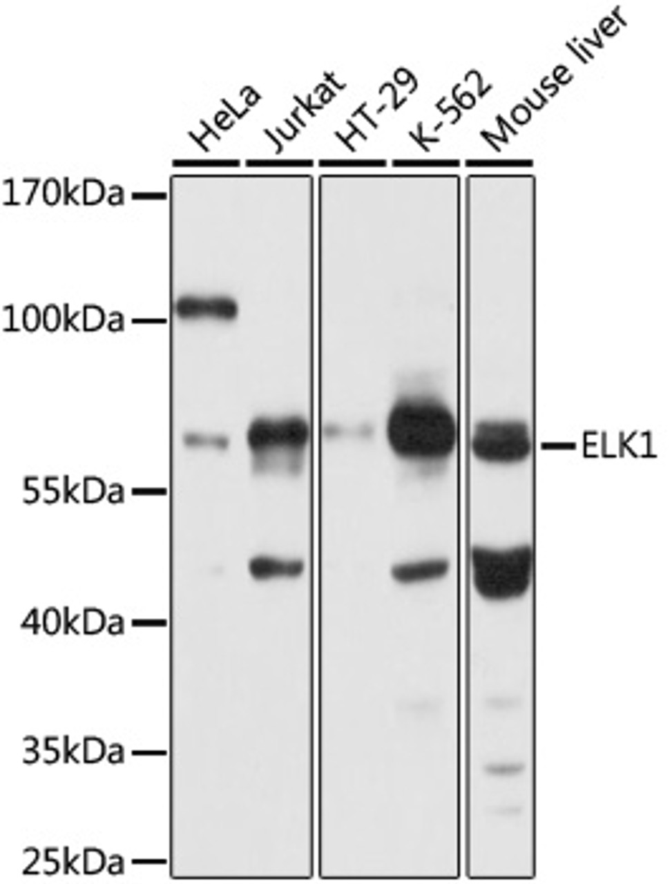 Western blot analysis of extracts of various cell lines, using ELK1 antibody (13-282) at 1:1000 dilution.<br/>Secondary antibody: HRP Goat Anti-Rabbit IgG (H+L) at 1:10000 dilution.<br/>Lysates/proteins: 25ug per lane.<br/>Blocking buffer: 3% nonfat dry milk in TBST.<br/>Detection: ECL Basic Kit.<br/>Exposure time: 3s.