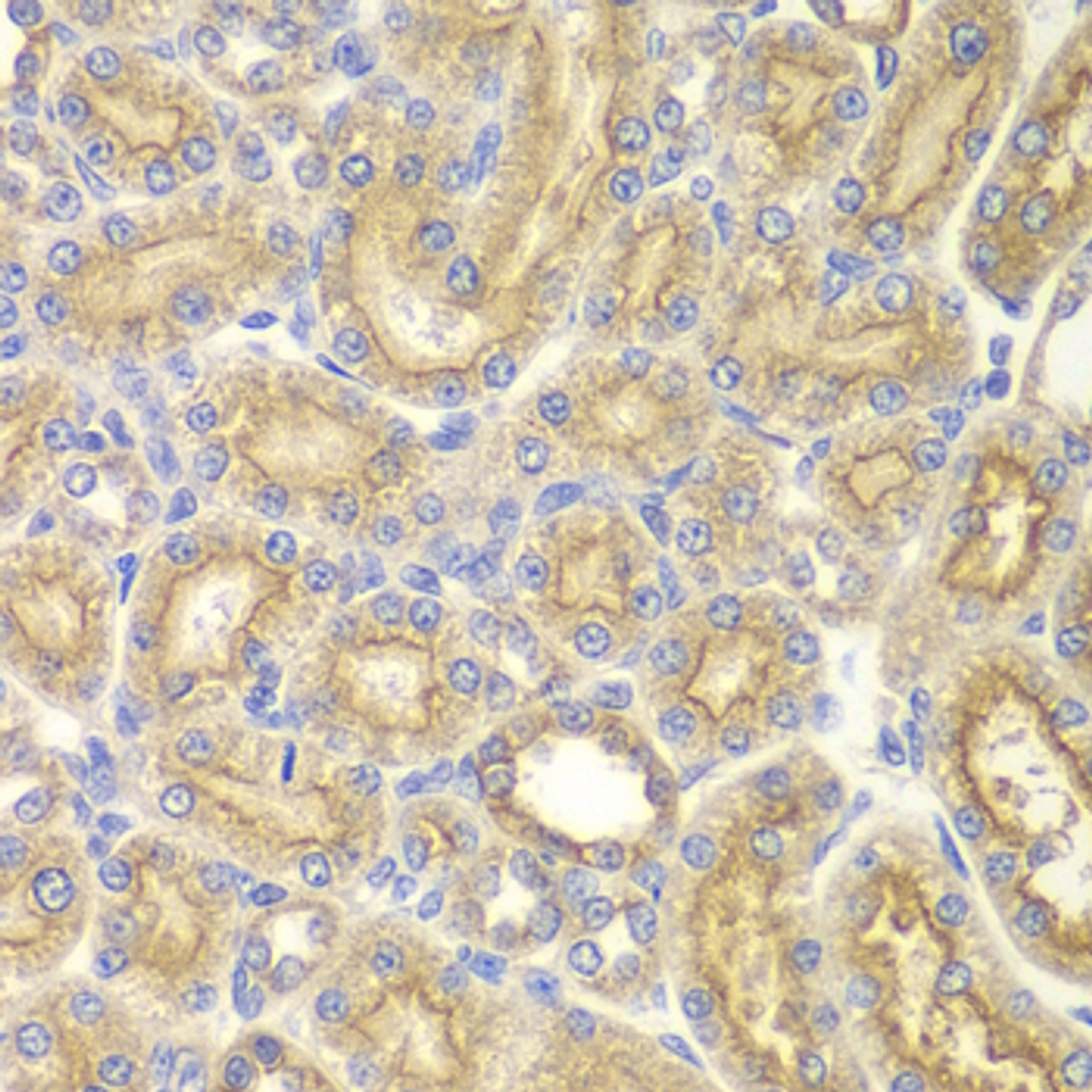 Immunohistochemistry of paraffin-embedded rat kidney using PAK1 antibody (13-284) at dilution of 1:200 (40x lens) .