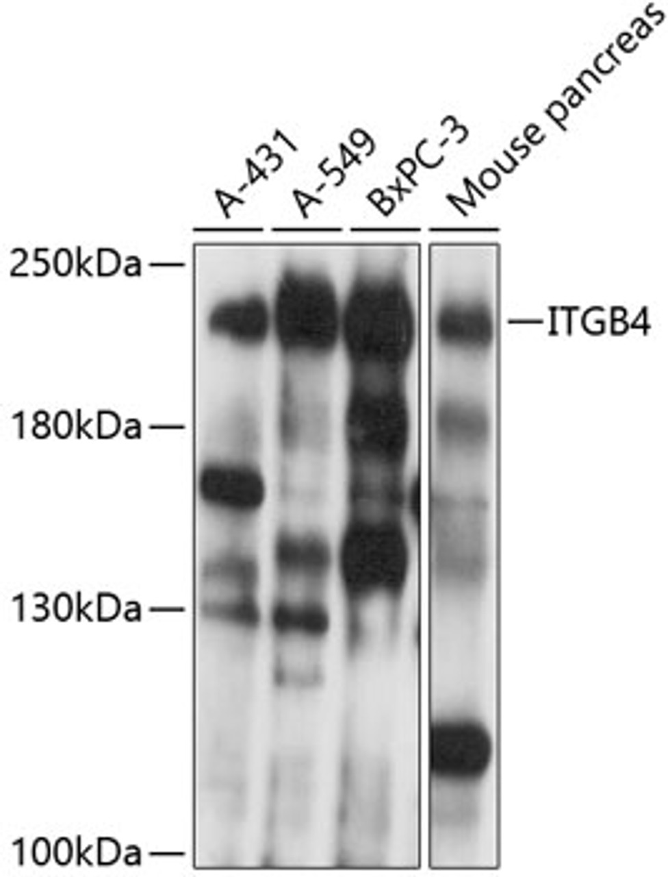 Western blot analysis of extracts of various cell lines, using ITGB4 antibody (13-306) at 1:1000 dilution.<br/>Secondary antibody: HRP Goat Anti-Rabbit IgG (H+L) at 1:10000 dilution.<br/>Lysates/proteins: 25ug per lane.<br/>Blocking buffer: 3% nonfat dry milk in TBST.<br/>Detection: ECL Basic Kit.<br/>Exposure time: 10s.