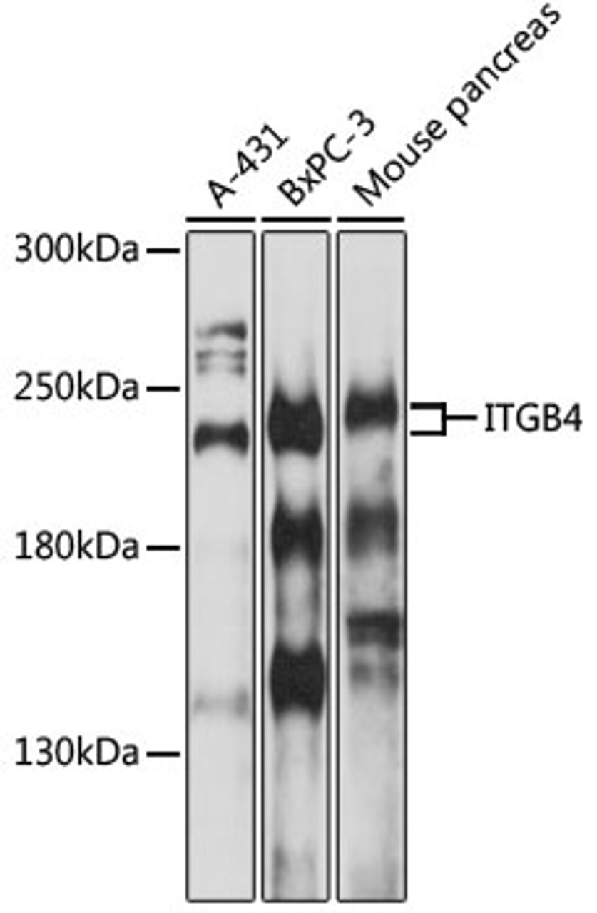 Western blot analysis of extracts of various cells, using ITGB4 antibody (13-306) at 1:1000 dilution.<br/>Secondary antibody: HRP Goat Anti-Rabbit IgG (H+L) at 1:10000 dilution.<br/>Lysates/proteins: 25ug per lane.<br/>Blocking buffer: 3% nonfat dry milk in TBST.<br/>Detection: ECL Basic Kit.<br/>Exposure time: 30s.