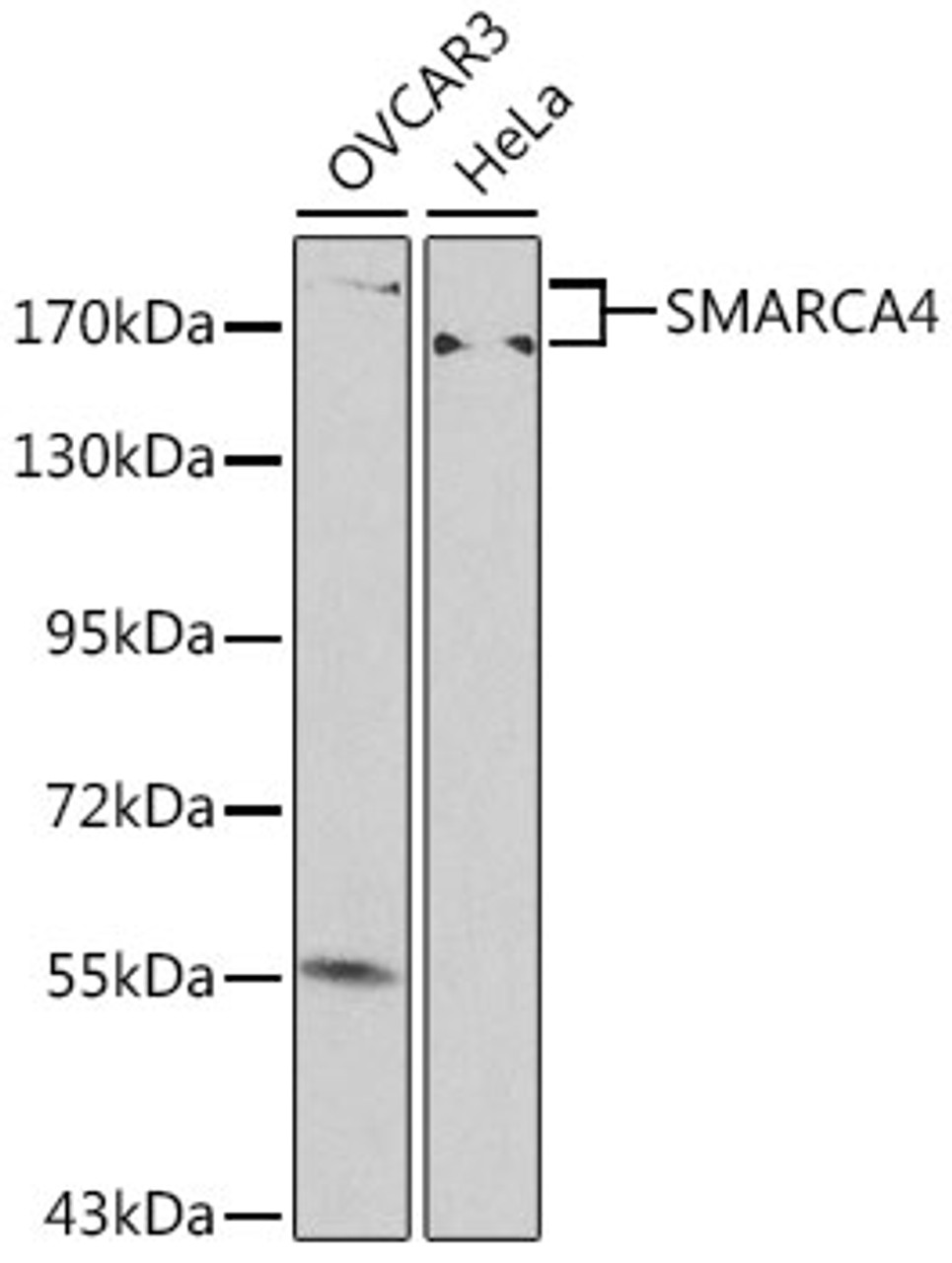 Western blot analysis of extracts of various cell lines, using SMARCA4 antibody (13-315) at 1:500 dilution.<br/>Secondary antibody: HRP Goat Anti-Rabbit IgG (H+L) at 1:10000 dilution.<br/>Lysates/proteins: 25ug per lane.<br/>Blocking buffer: 3% nonfat dry milk in TBST.