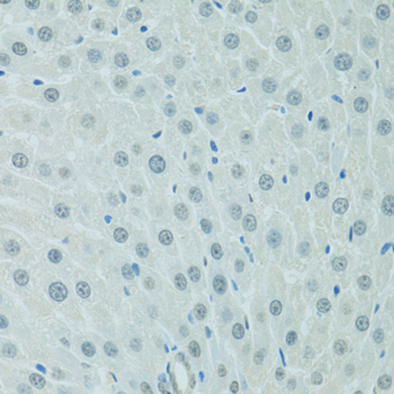 Immunohistochemistry of paraffin-embedded rat liver using CEBPA antibody (13-318) at dilution of 1:100 (40x lens) .