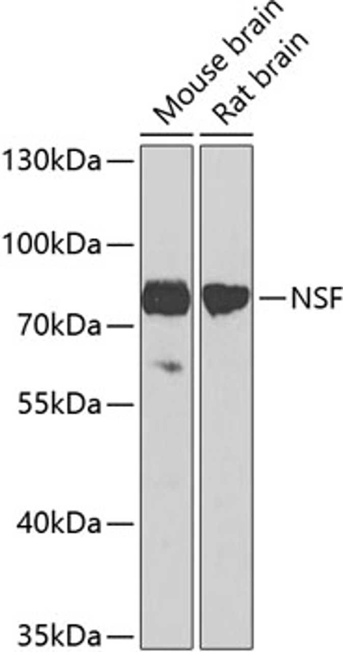 Western blot analysis of extracts of various cell lines, using NSF antibody (13-323) at 1:1000 dilution.<br/>Secondary antibody: HRP Goat Anti-Rabbit IgG (H+L) at 1:10000 dilution.<br/>Lysates/proteins: 25ug per lane.<br/>Blocking buffer: 3% nonfat dry milk in TBST.<br/>Detection: ECL Basic Kit.<br/>Exposure time: 15s.