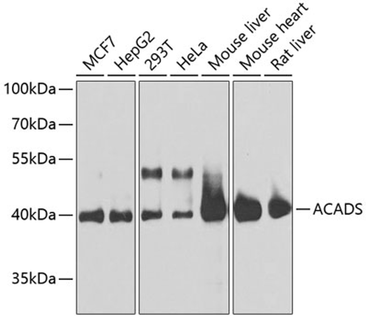 Western blot analysis of extracts of various cell lines, using ACADS antibody (13-328) at 1:1000 dilution.<br/>Secondary antibody: HRP Goat Anti-Rabbit IgG (H+L) at 1:10000 dilution.<br/>Lysates/proteins: 25ug per lane.<br/>Blocking buffer: 3% nonfat dry milk in TBST.<br/>Detection: ECL Basic Kit.<br/>Exposure time: 15s.