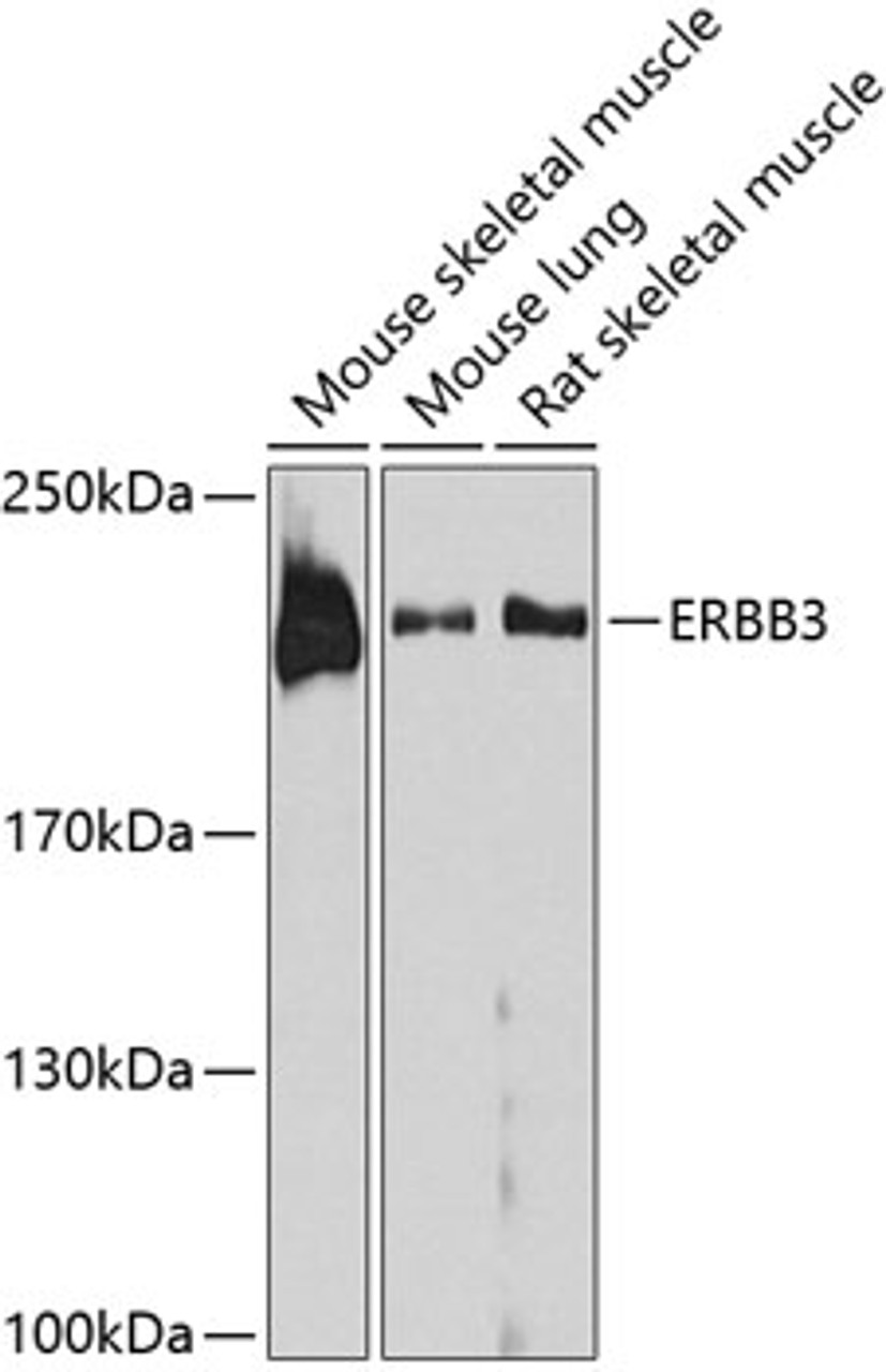 Western blot analysis of extracts of various cell lines, using ERBB3 antibody (13-331) at 1:1000 dilution.<br/>Secondary antibody: HRP Goat Anti-Rabbit IgG (H+L) at 1:10000 dilution.<br/>Lysates/proteins: 25ug per lane.<br/>Blocking buffer: 3% nonfat dry milk in TBST.<br/>Detection: ECL Basic Kit.<br/>Exposure time: 90s.