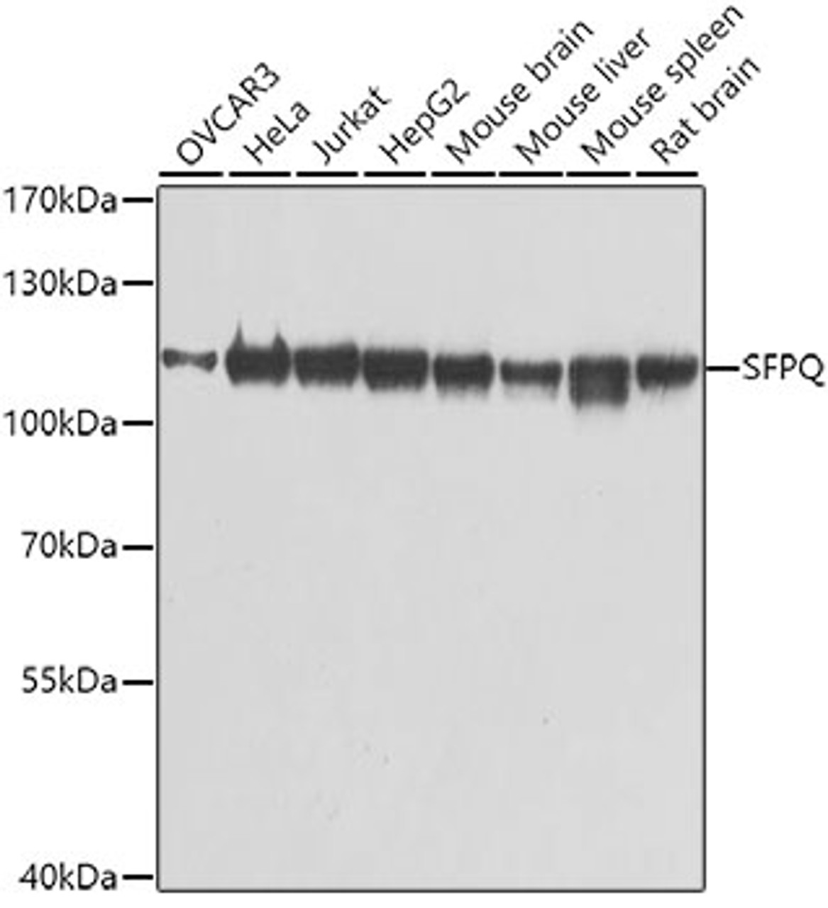 Western blot analysis of extracts of various cell lines, using SFPQ antibody (13-336) at 1:1000 dilution.<br/>Secondary antibody: HRP Goat Anti-Rabbit IgG (H+L) at 1:10000 dilution.<br/>Lysates/proteins: 25ug per lane.<br/>Blocking buffer: 3% nonfat dry milk in TBST.<br/>Detection: ECL Basic Kit.<br/>Exposure time: 1s.