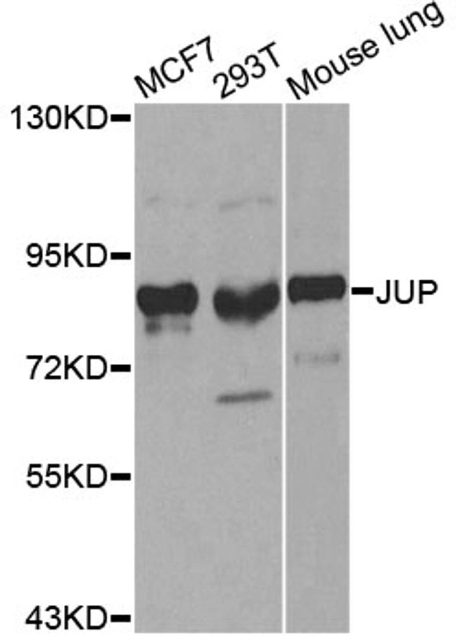 Western blot analysis of extracts of various cell lines, using JUP antibody (13-339) at 1:500 dilution.<br/>Secondary antibody: HRP Goat Anti-Rabbit IgG (H+L) at 1:10000 dilution.<br/>Lysates/proteins: 25ug per lane.<br/>Blocking buffer: 3% nonfat dry milk in TBST.<br/>Detection: ECL Basic Kit.