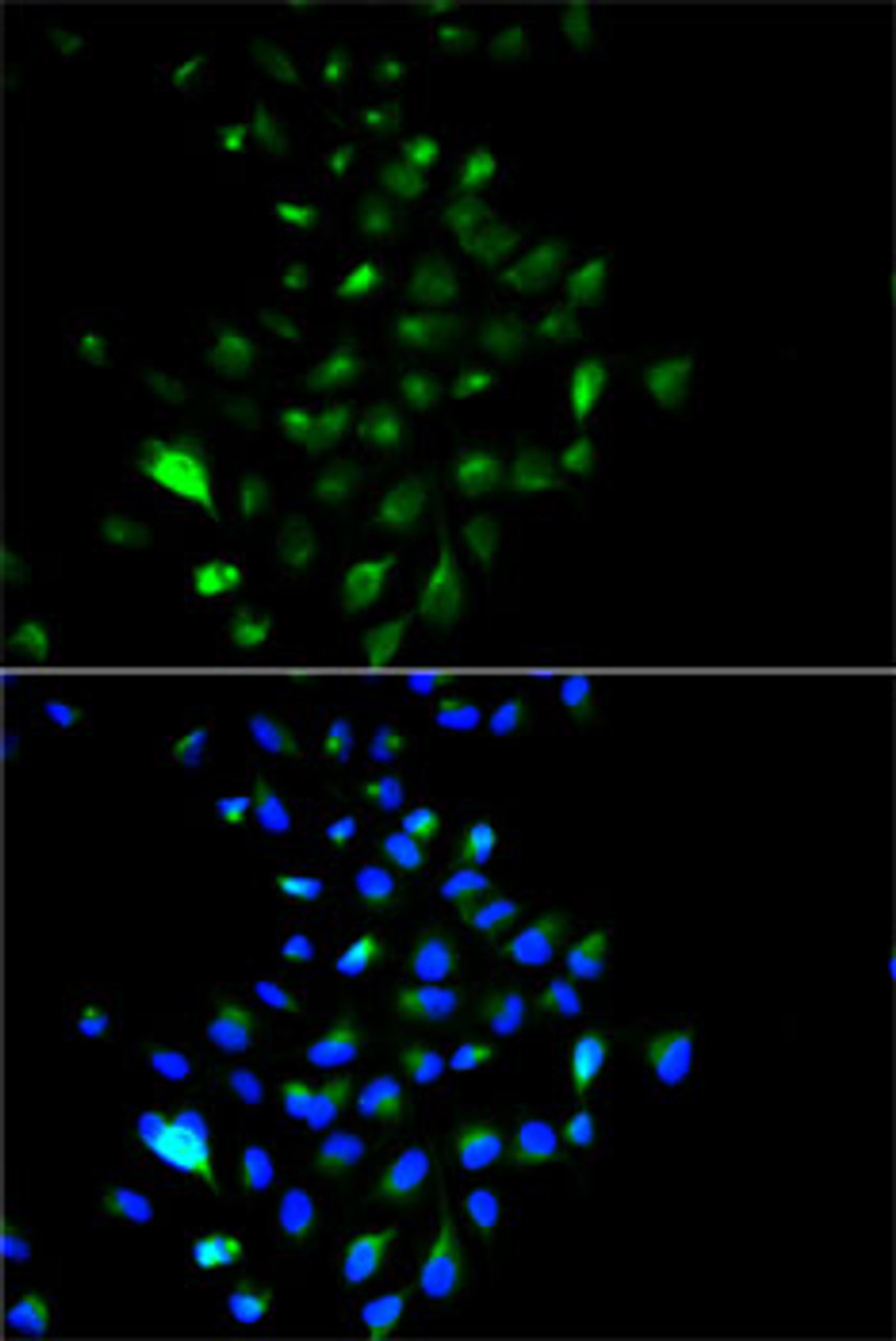 Immunofluorescence analysis of HeLa cells using JUP antibody (13-339) . Blue: DAPI for nuclear staining.